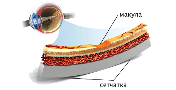 дистрофия сетчатки лечение