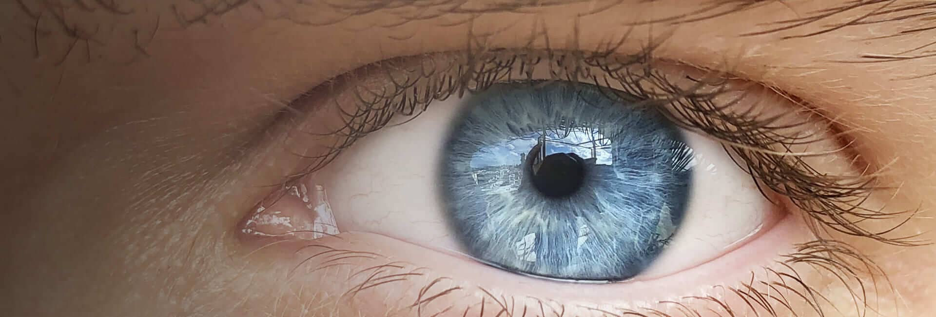 Центр хирургии глаза