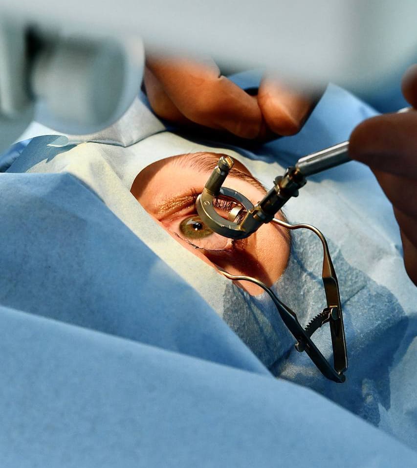 Лазерная коррекция зрения